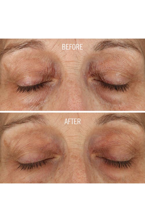 First Aid Beauty Fab Skin Lab Retinol Eye Cream