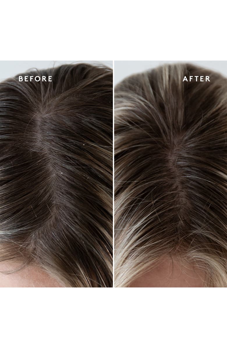 Virtue<sup>®</sup> Exfoliating Scalp Treatment, Alternate, color, 