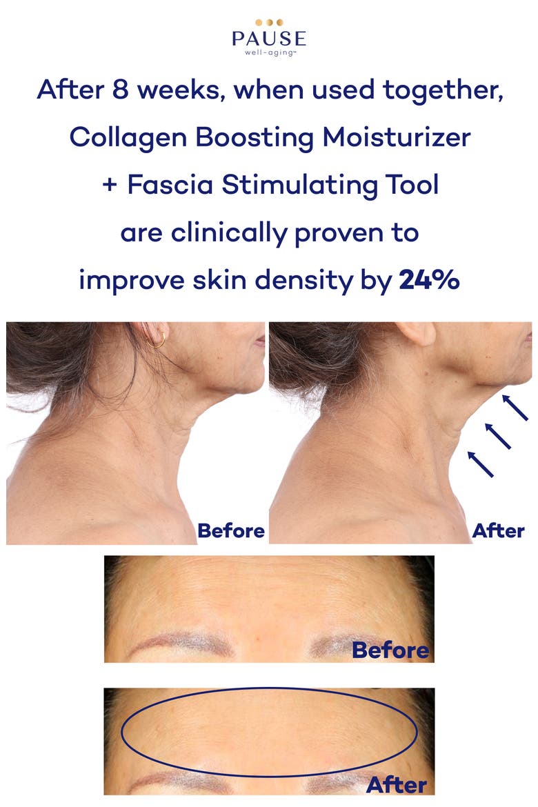Fascia Stimulating Tool, Alternate, color, NO COLOR