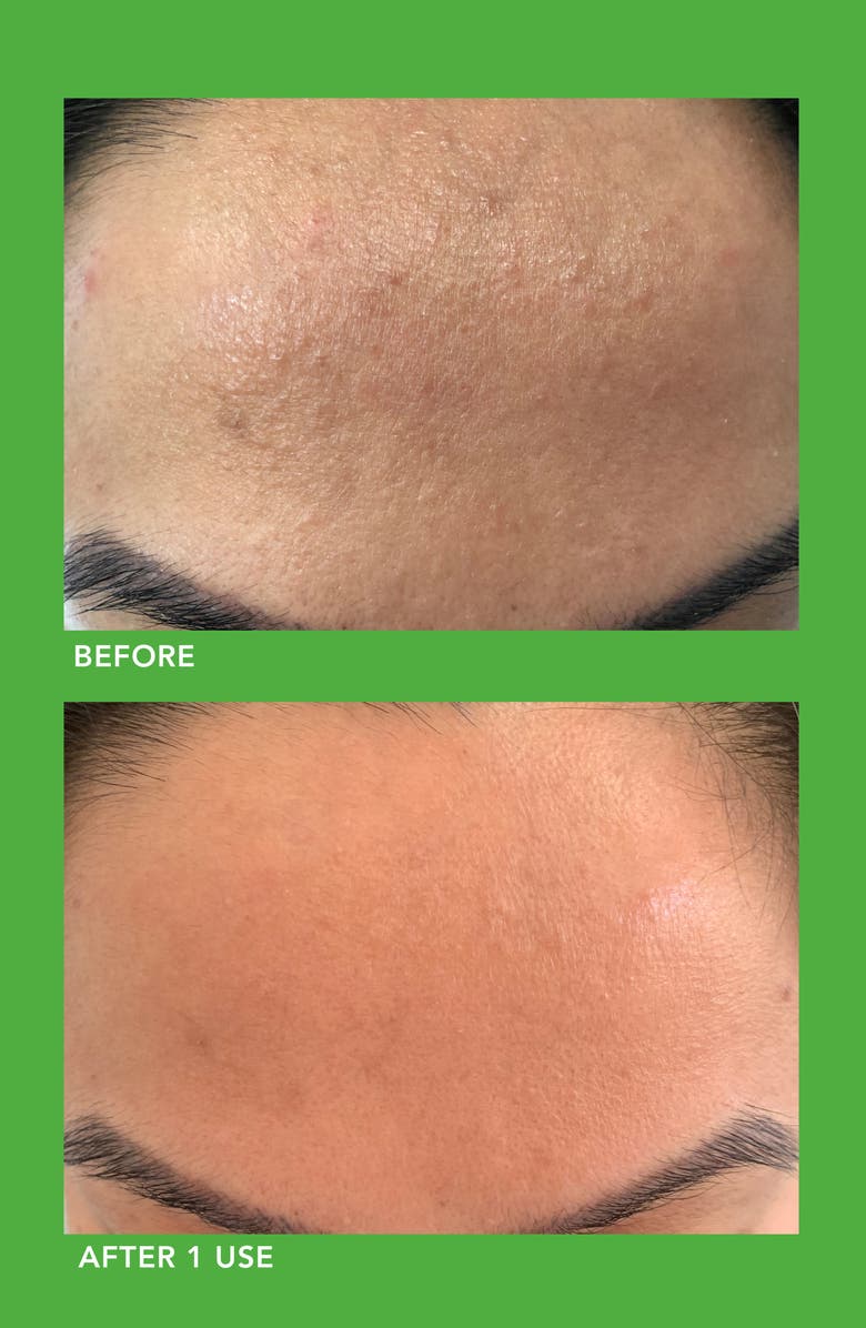 LANCER Skincare Clarifying Detox Mask, Alternate, color, 