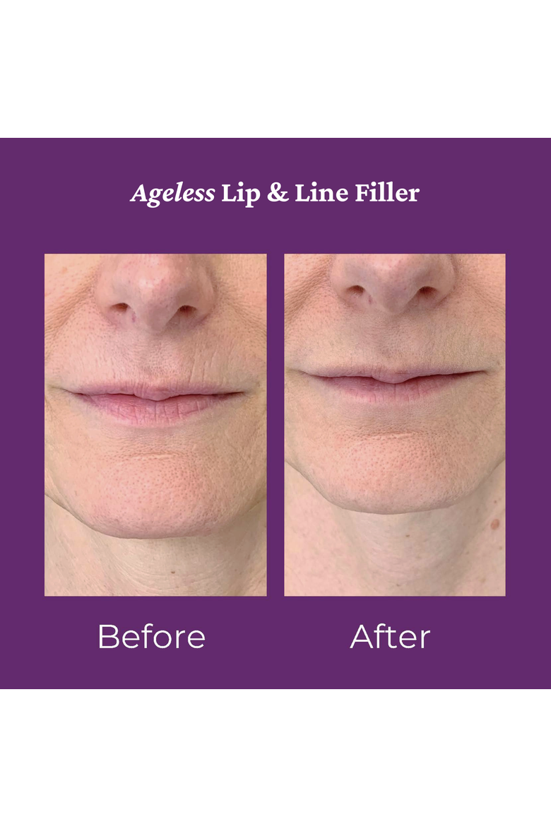 Ageless Lip Line Filler 8ml, Alternate, color, None