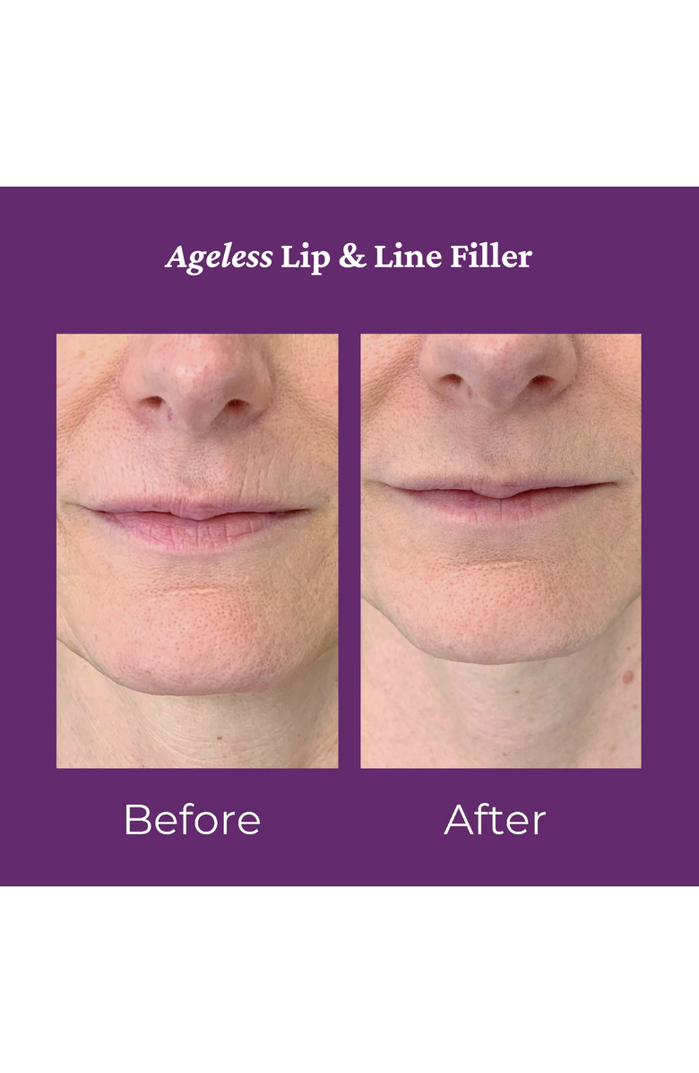 PRAI BEAUTY Ageless Lip Line Filler 8ml, Alternate, color, NO COLOR