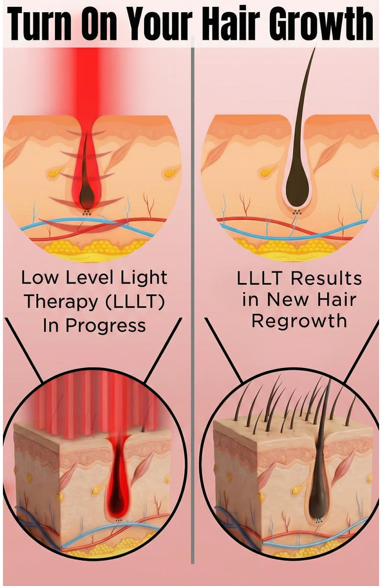 Lovery Laser Cap LED Red & Blue Light Therapy Hat - 48 LED Hair & Scalp Treatment Device with 10-Minute Auto Timer, Alternate, color, Black