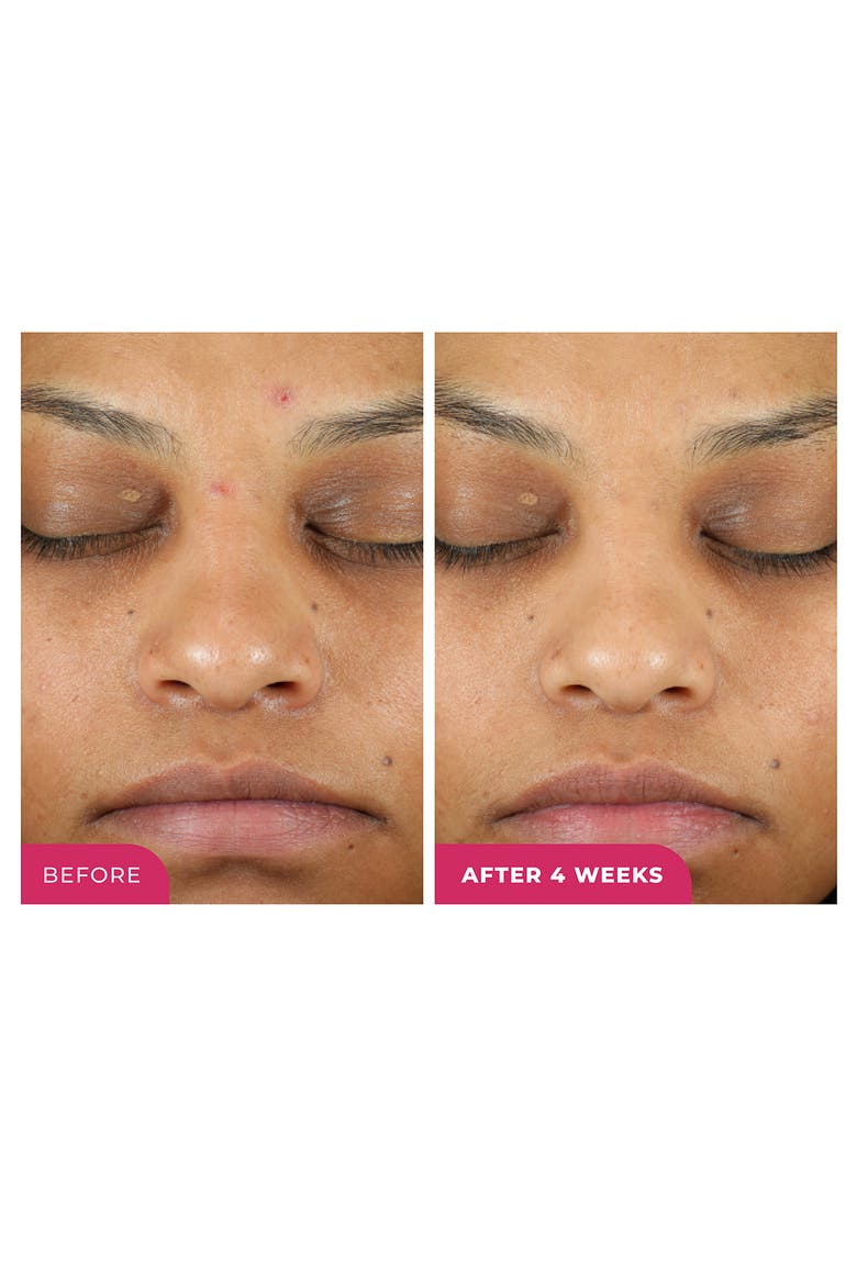 Triple Action One-Step Daily Exfoliating Peel Pad, Alternate, color, NO COLOR