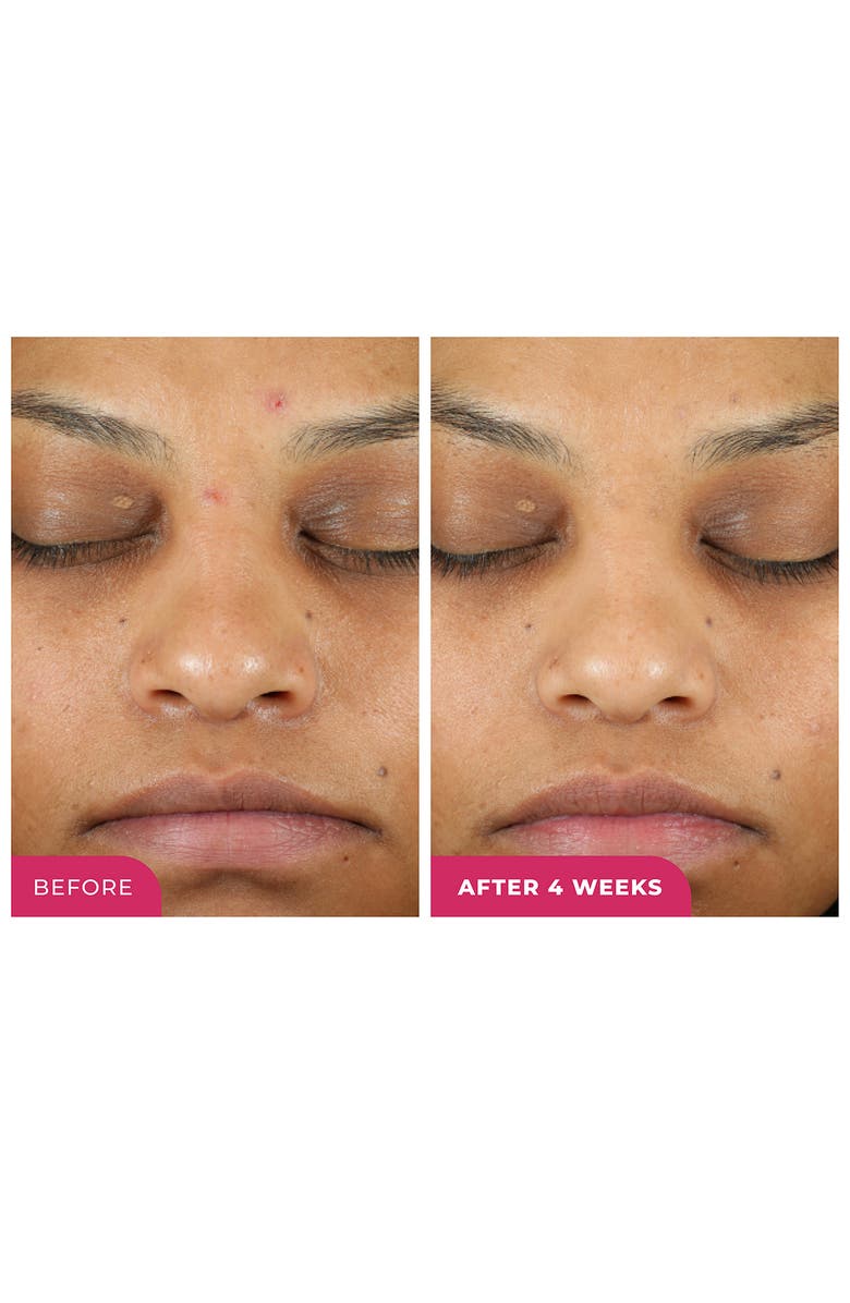 BeautyStat Triple Action One-Step Daily Exfoliating Peel Pad, Alternate, color, 