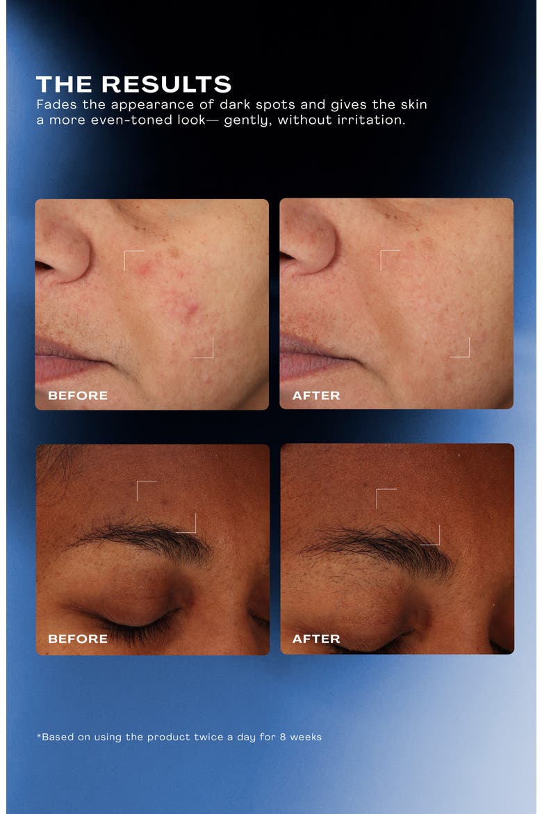 Total Clarity Dark Spot Serum, Alternate, color, NO COLOR