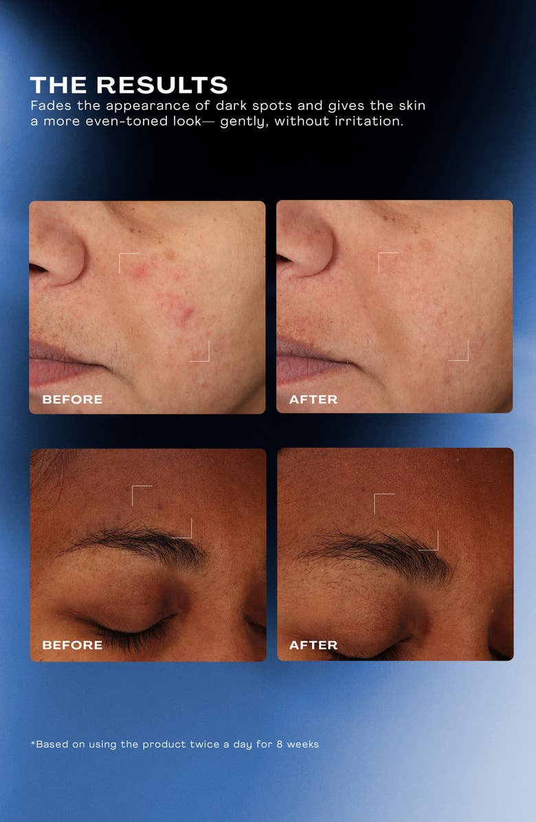 The Outset Total Clarity Dark Spot Serum, Alternate, color,