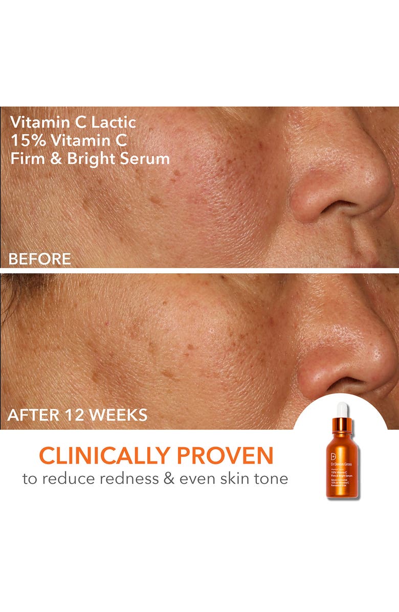 Dr. Dennis Gross Skincare AM/PM Gold Standard Kit (Limited Edition) USD $184 Value, Alternate, color, 