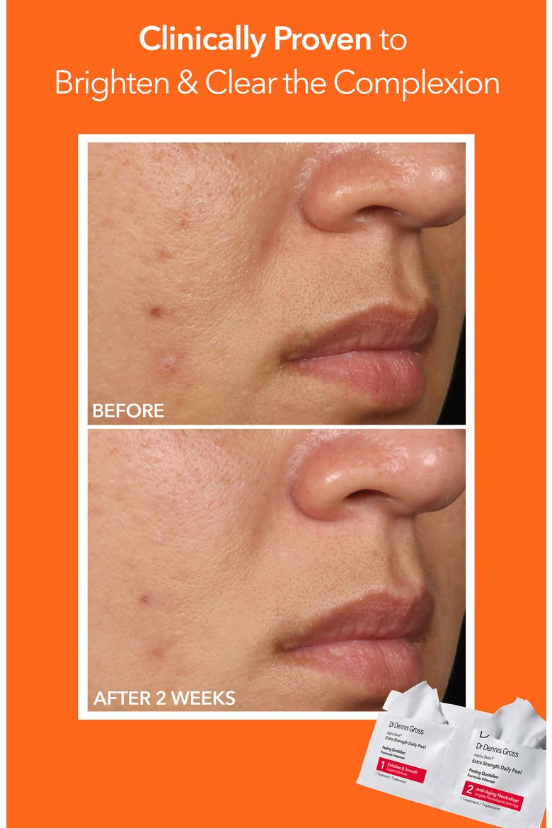 Alpha Beta® Peel Extra Strength Formula - 30 Applications, Alternate, color, NO COLOR