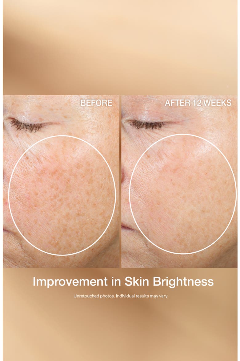 Multi-Action Super-C Retinol Brighten & Correct Vitamin C Serum, Alternate, color, NO COLOR
