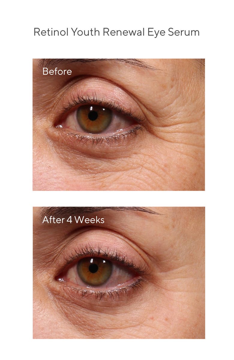 Murad<sup>®</sup> Youth Renewal Retinol Discovery Set, Alternate, color, 