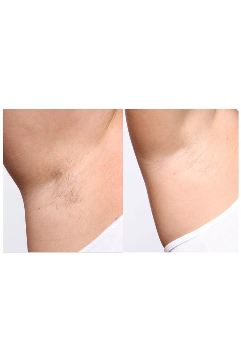 Flash&Go Jewel Hair Removal Device, Alternate, color, NO COLOR