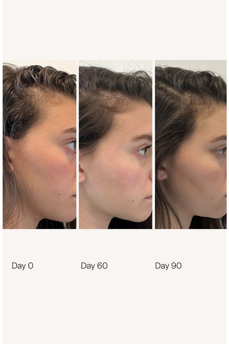 Scalp Care Density Serum, Alternate, color, NO COLOR