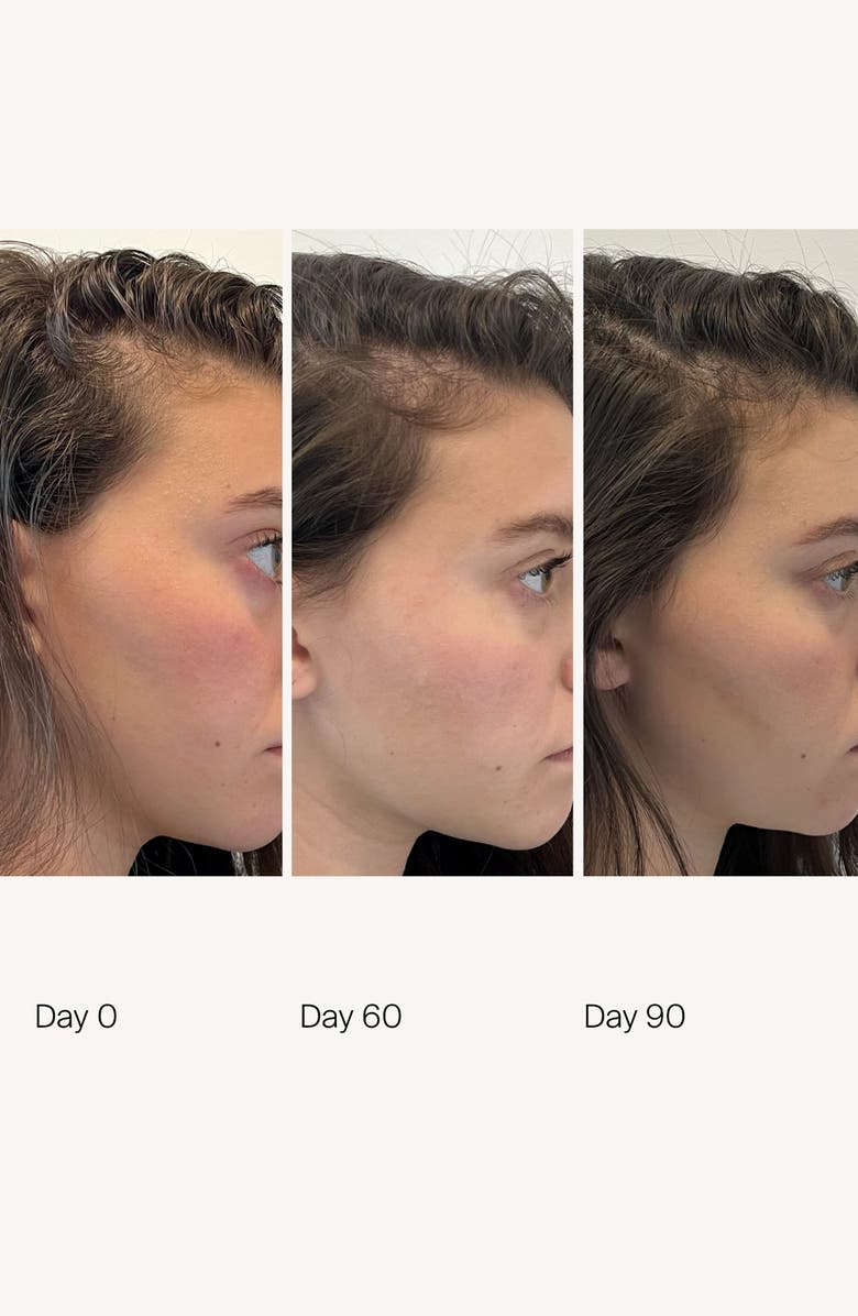 Living proof<sup>®</sup> Scalp Care Density Serum, Alternate, color,