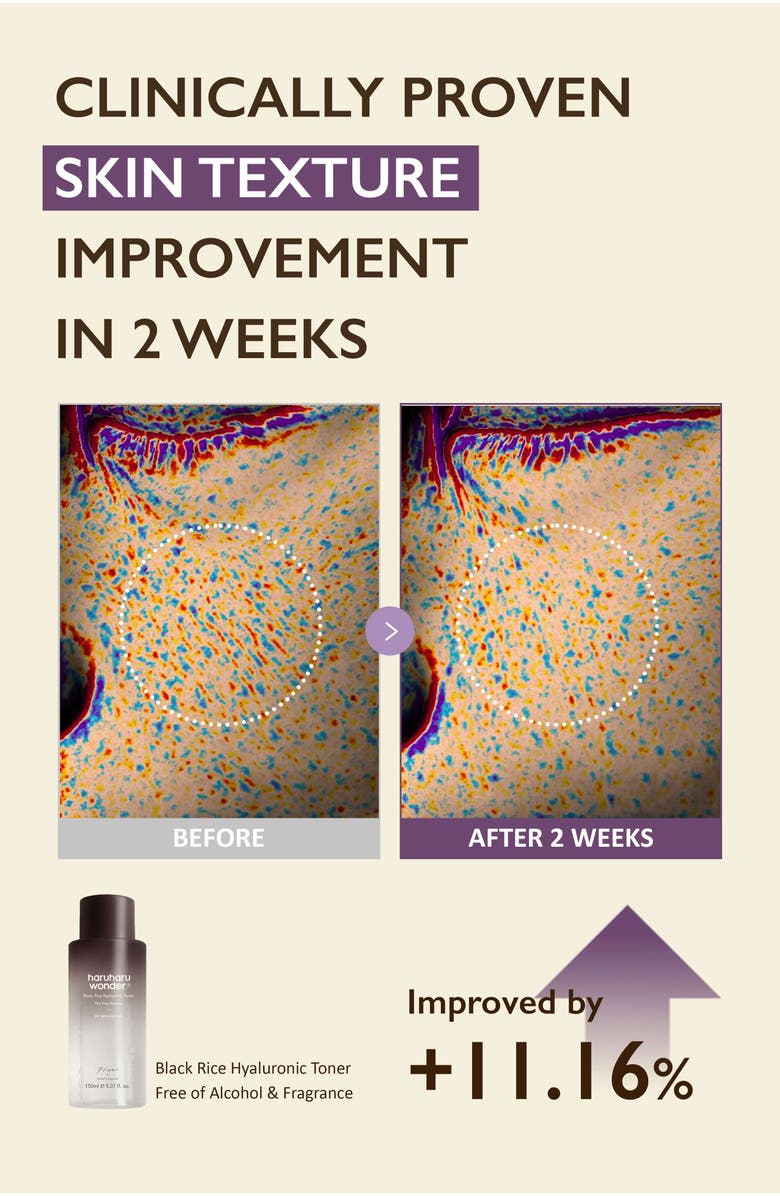 haruharu wonder Cleanse & Glow Set, Alternate, color, NO COLOR