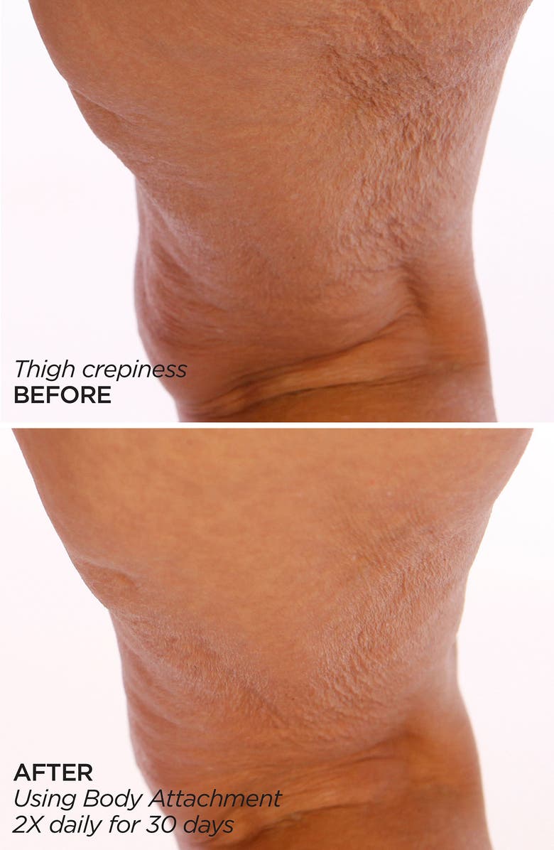 BeautyBio GloPRO<sup>®</sup> BODY MicroTip<sup>™</sup> Attachment Replacement Head, Alternate, color,