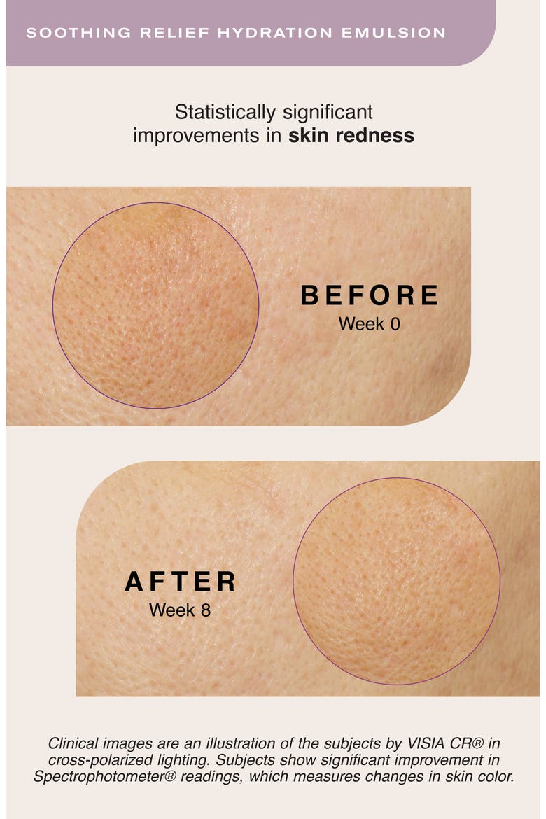 Soothing Relief Hydration Emulsion, Alternate, color, NO COLOR