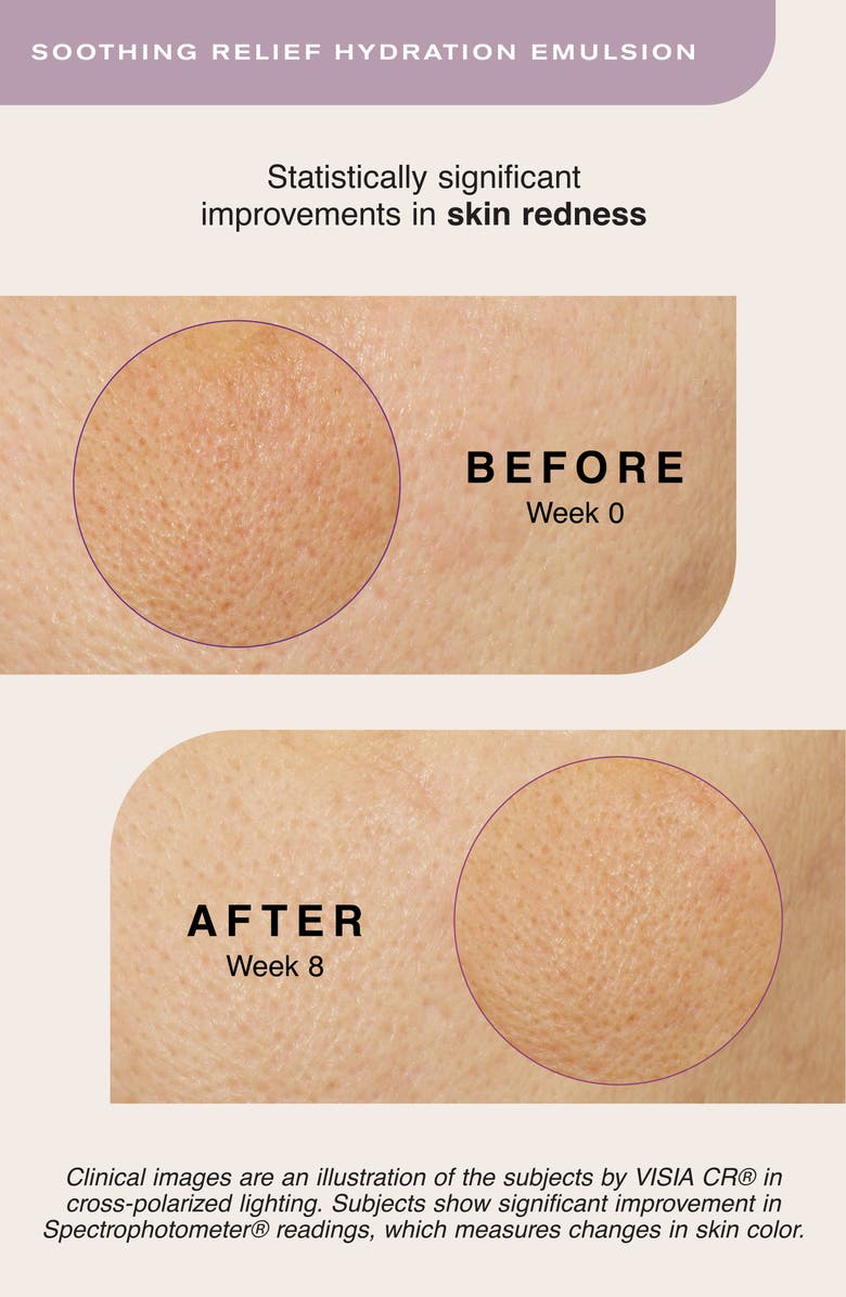 Erno Laszlo Soothing Relief Hydration Emulsion, Alternate, color,