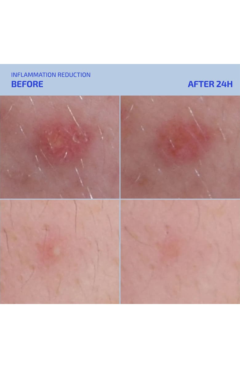 Codex Labs SHAANT Spot Hero, Alternate, color, Tan