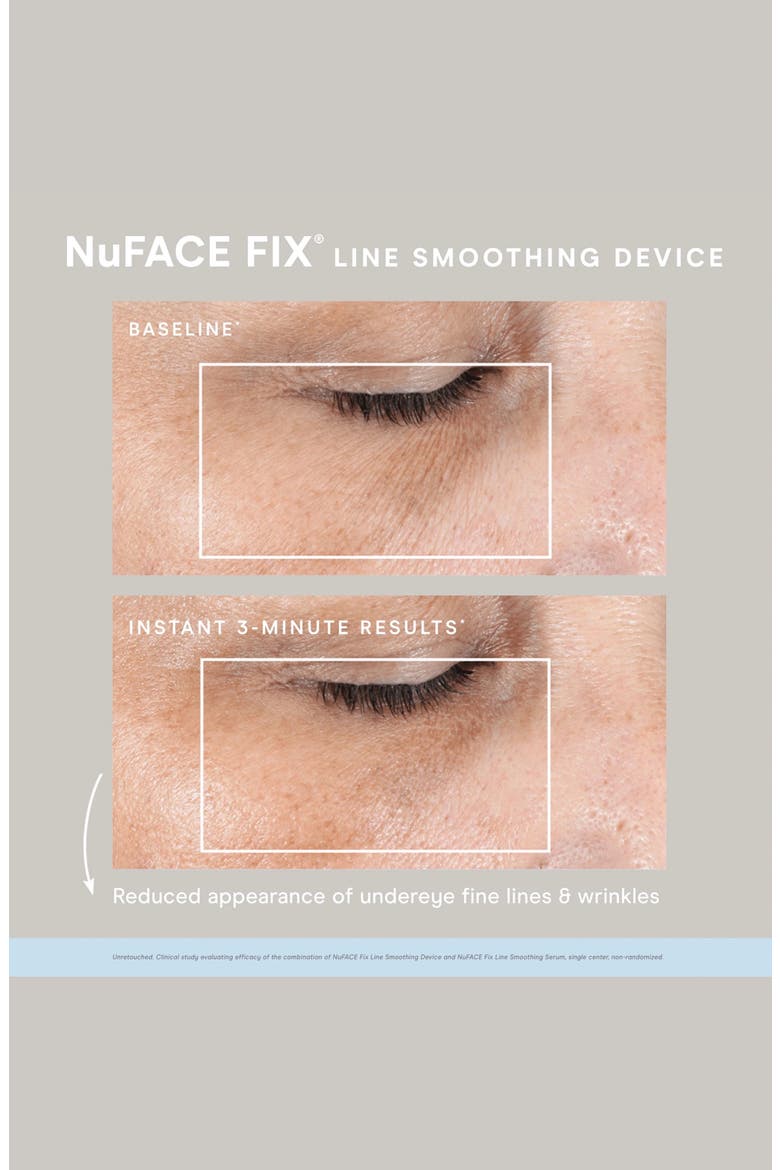 FIX Line Smoothing Device & Serum Set $165 Value, Alternate, color, NO COLOR