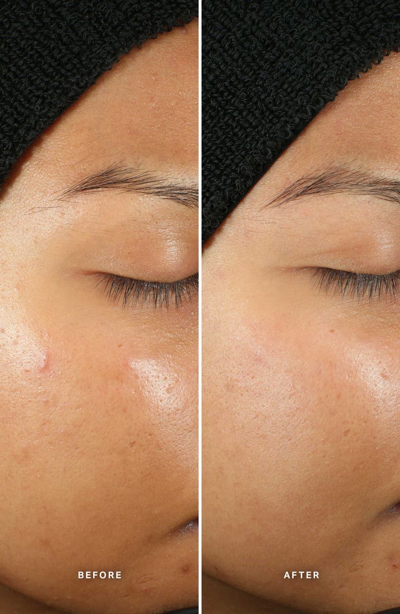 Alpha-H Generation Glow Daily Resurfacing Essence, Alternate, color, 