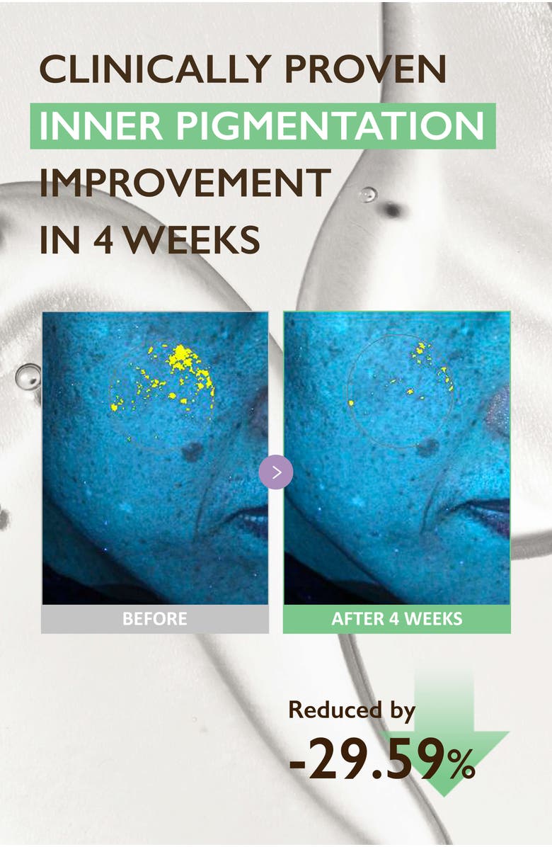 haruharu wonder Centella 4% TXA Dark Spot Go Away Serum, Alternate, color, NO COLOR