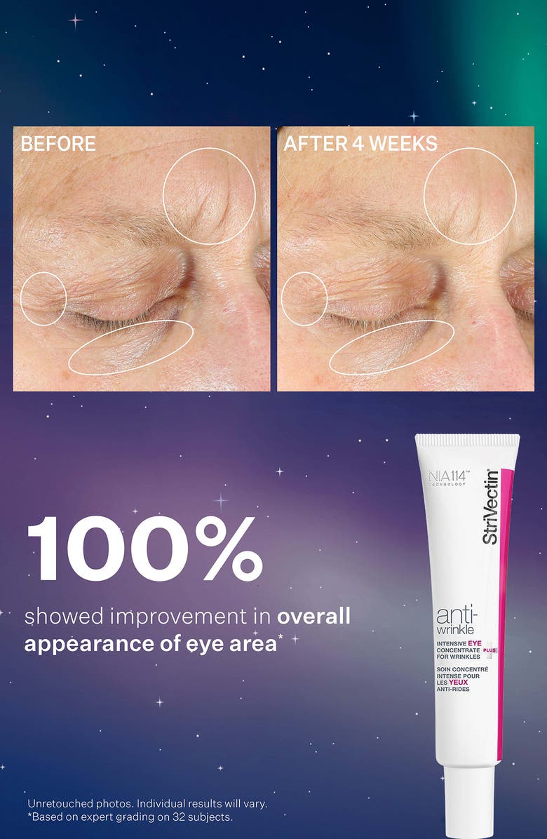 StriVectin<sup>®</sup> Smooth & Plump Holiday Skin Care Set (Limited Edition) $193 Value, Alternate, color, 