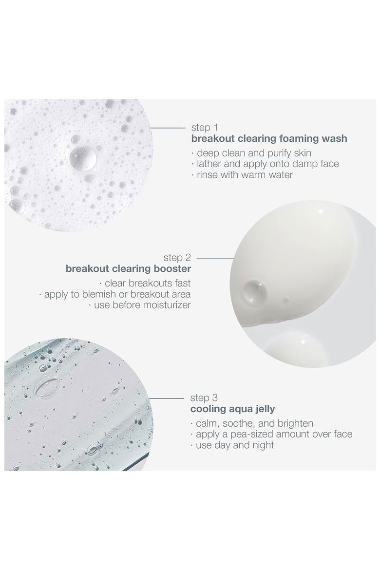 Breakout Clearing Kit $36.50 Value, Alternate, color, NONE