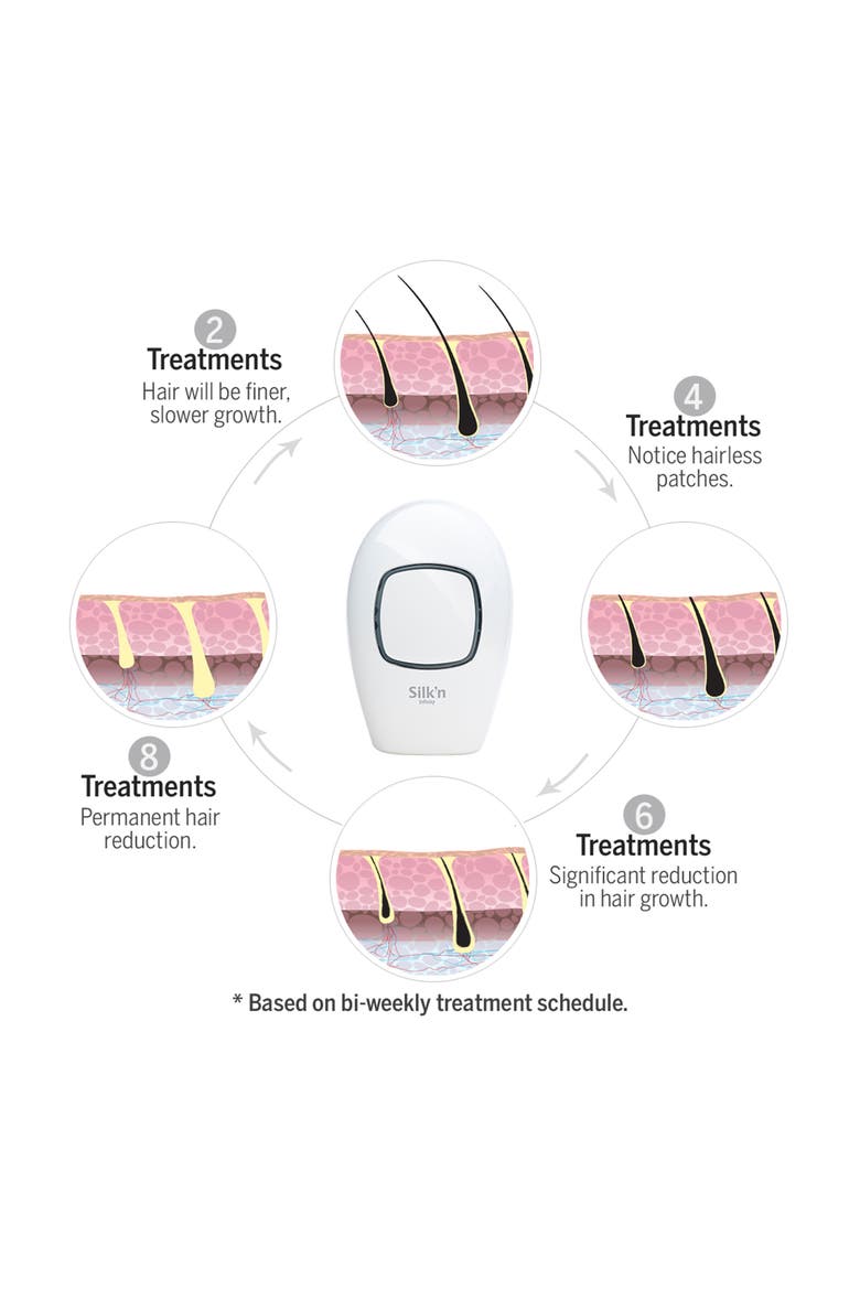 Infinity Hair Removal Device - Refurbished, Alternate, color, WHITE