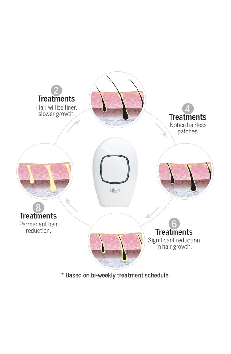 Silk'n Infinity Hair Removal Device - Refurbished, Alternate, color,