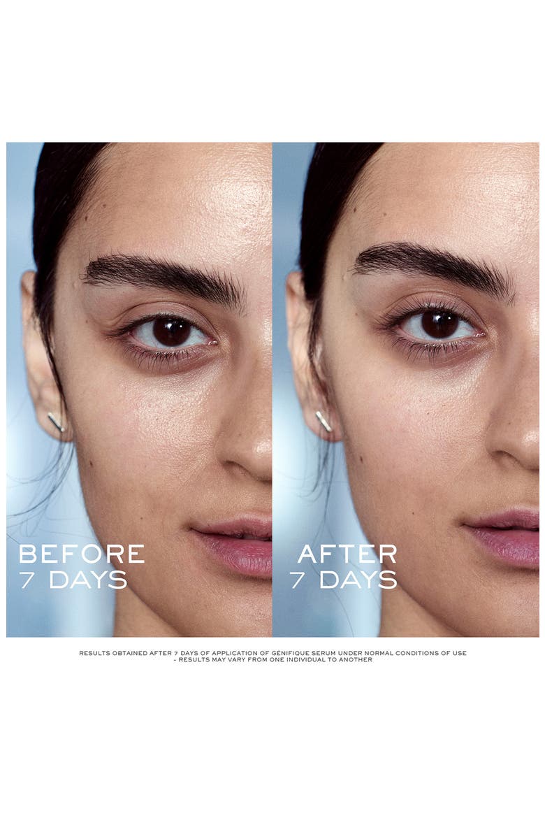 Advanced Génifique Youth Activating Concentrate Anti-Aging Face Serum $260 Value, Alternate, color, NO COLOR