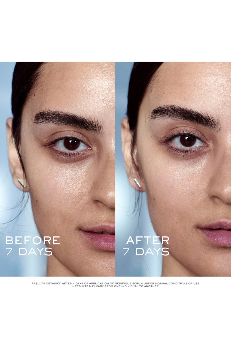 Lancôme Advanced Génifique Youth Activating Concentrate Anti-Aging Face Serum $260 Value, Alternate, color,