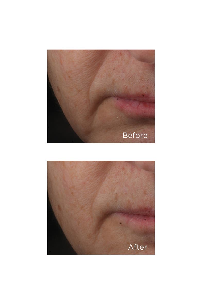 Cold Plasma Plus+ Advanced Serum Concentrate, Alternate, color, NO COLOR