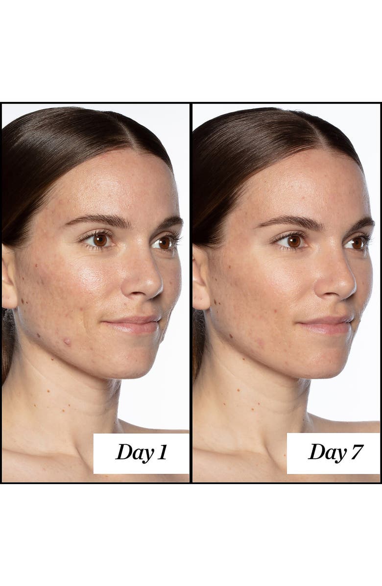 Sunday Riley Good Genes All-In-One Lactic Acid Treatment Home & Away Kit, Alternate, color,