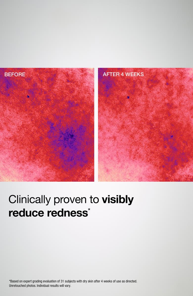 StriVectin<sup>®</sup> Barrier Restore+ Soothing Ceramide Cream, Alternate, color,