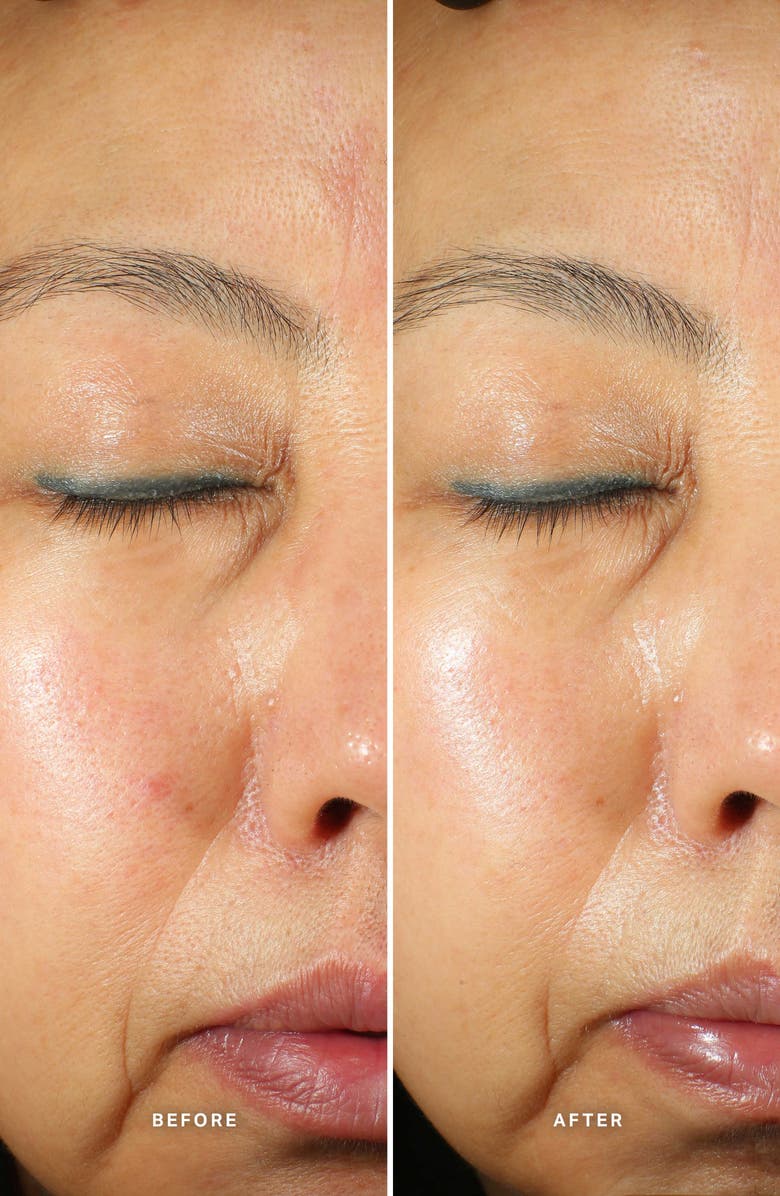 Alpha-H Generation Glow Daily Resurfacing Essence, Alternate, color, 