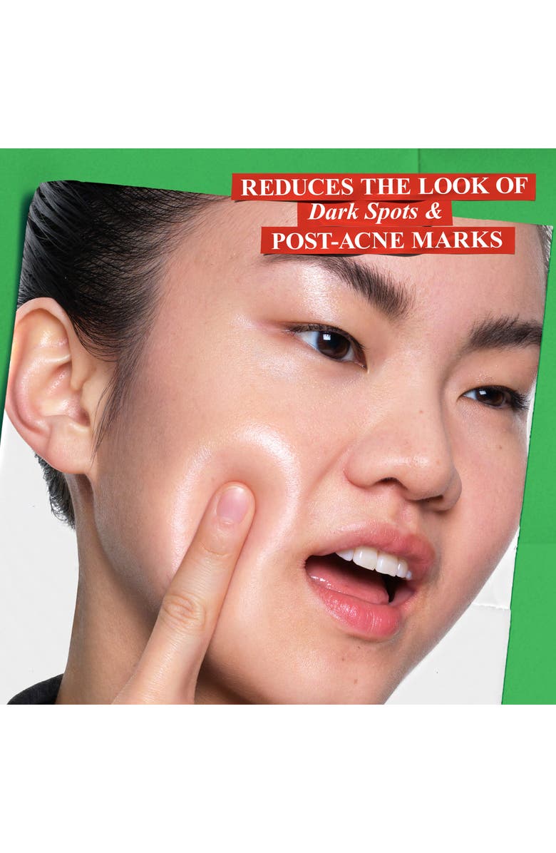 Kiehl's Since 1851 Clearly Corrective<sup>™</sup> Dark Spot Solution Duo, Alternate, color, 