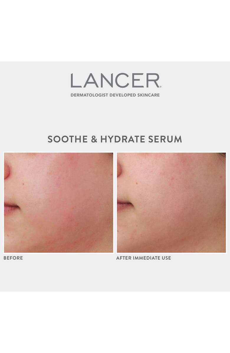 LANCER Skincare Soothe & Hydrate Serum, Alternate, color, 