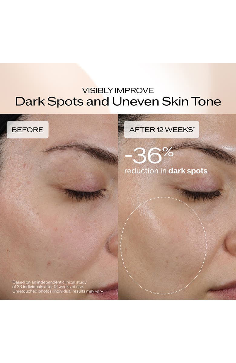 Shiseido Benefiance Dark Spot and Wrinkle Smoothing Serum, Alternate, color, 