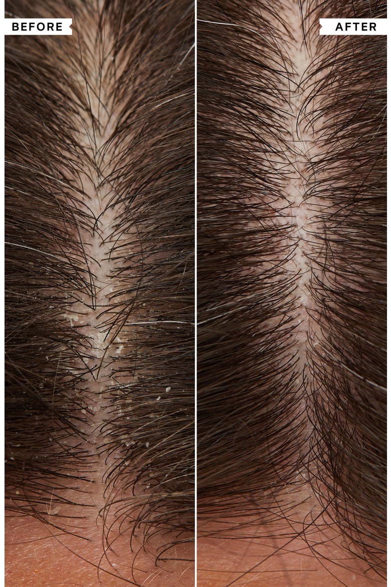 Flaky Scalp Cleansing Shampoo, Alternate, color, NO COLOR