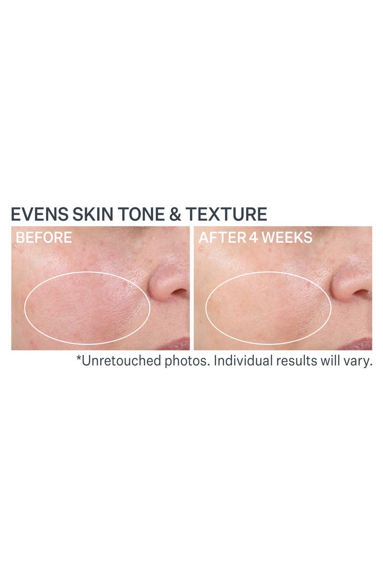Advanced Retinol Nightly Renewal Moisturizer, Alternate, color, NO COLOR