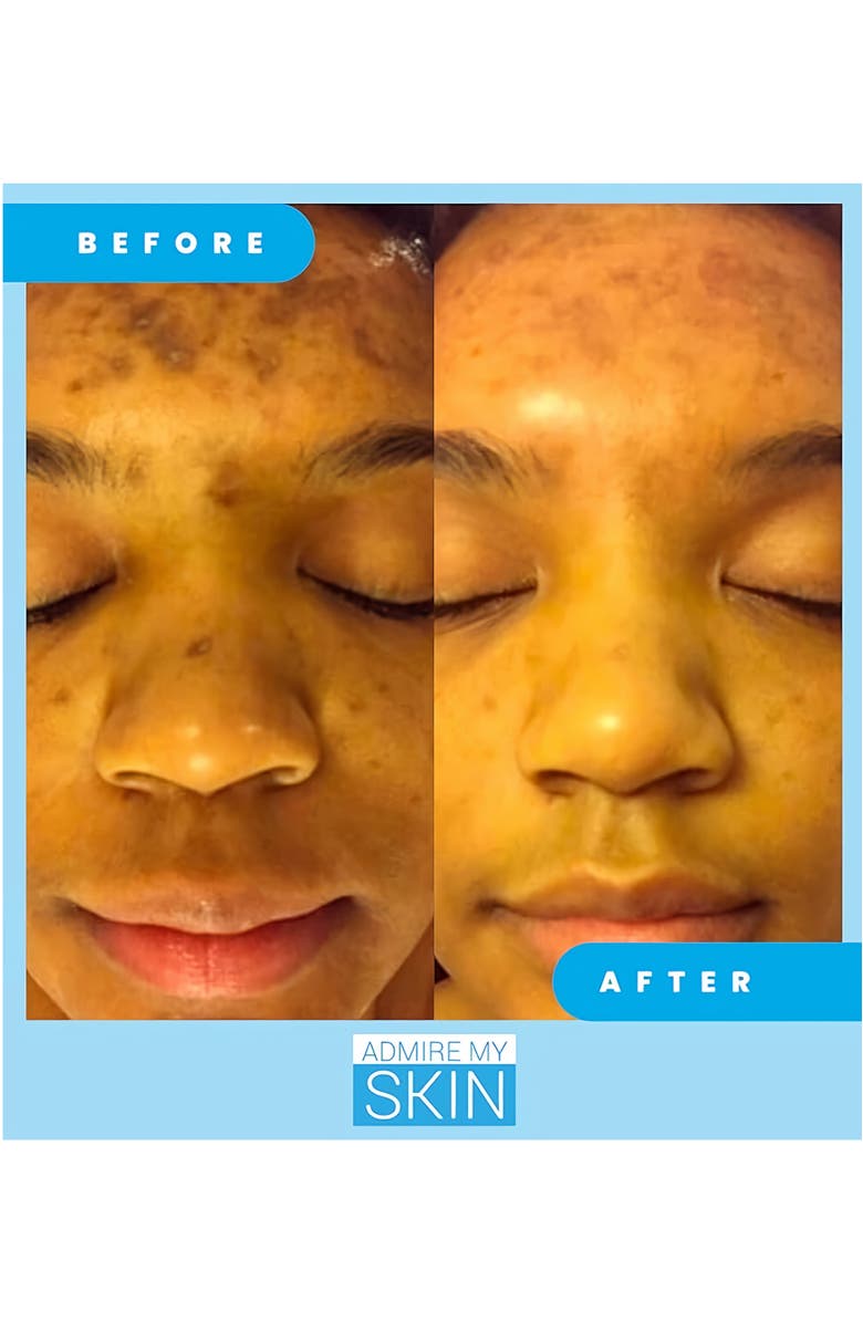 Admire My Skin Ultra Potent Brightening Serum Dark Spot Corrector, Alternate, color, Clear
