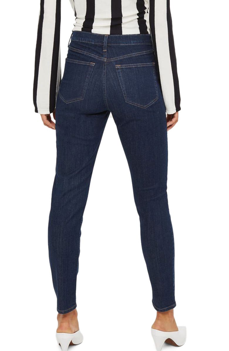 Topshop Jamie High Waist Ankle Skinny Jeans, Alternate, color,