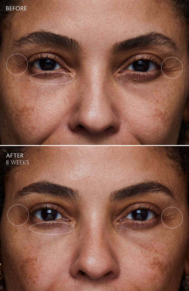 Clé de Peau Beauté Enhancing Eye Contour Cream Supreme, Alternate, color, 