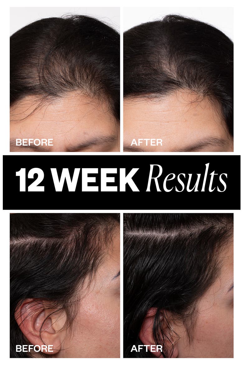 High Density Scalp Treatment, Alternate, color, NO COLOR