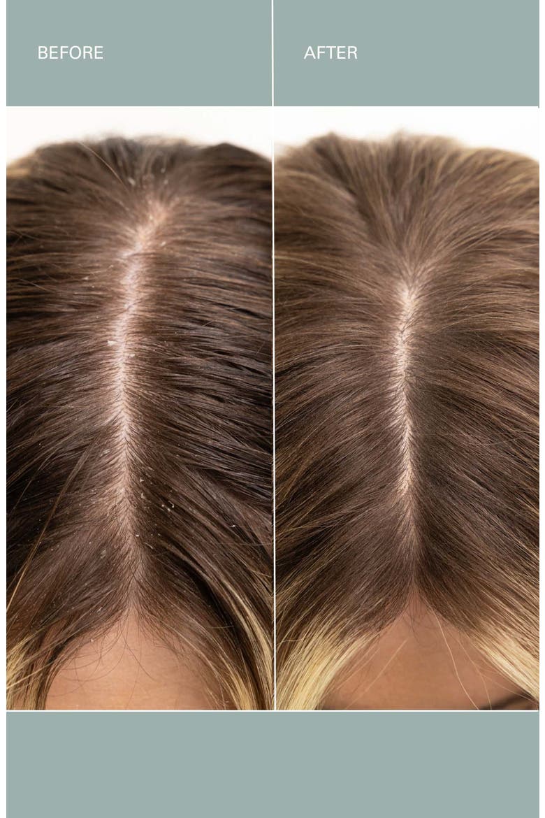 Salt Scalp Scrub, Alternate, color, NO COLOR