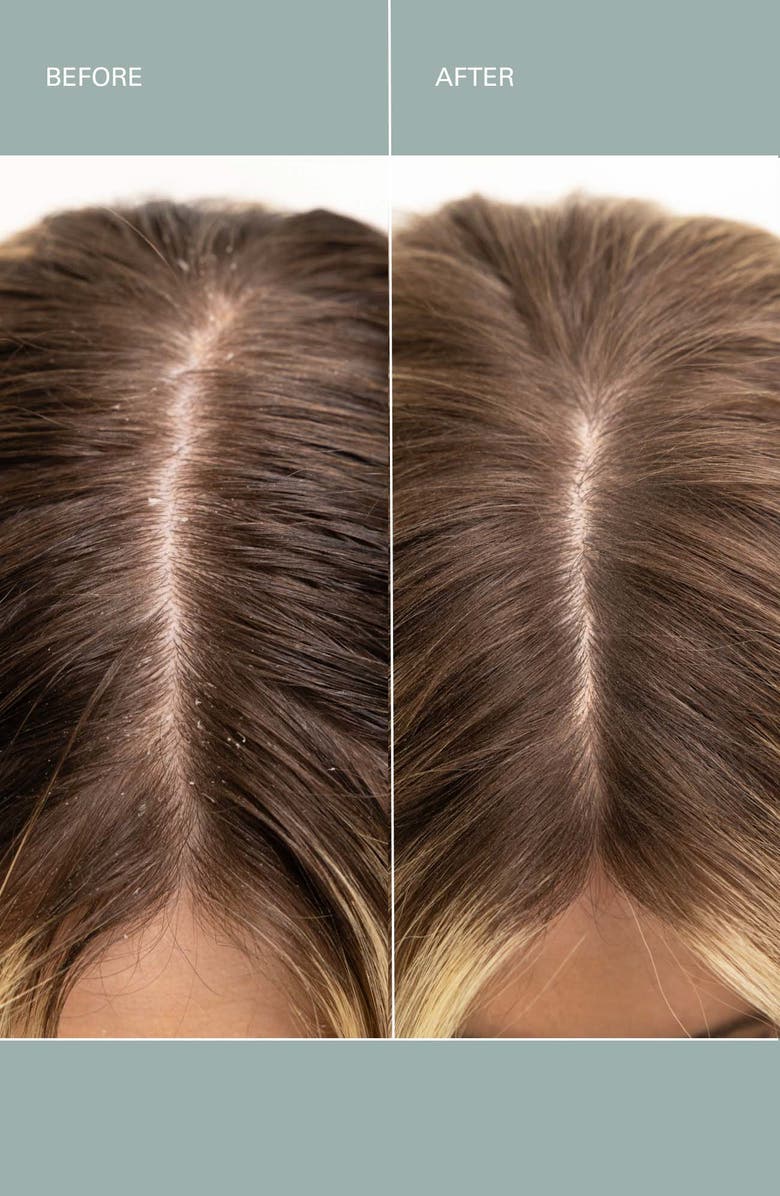 ROZ Salt Scalp Scrub, Alternate, color, 