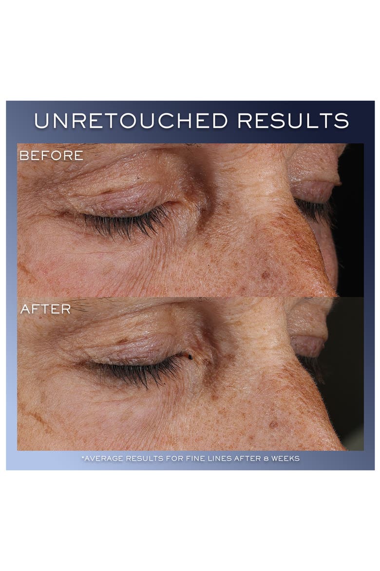 Advanced Génifique Yeux Eye Cream, Alternate, color, NO COLOR