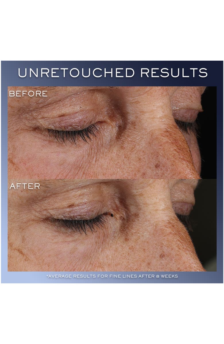 Lancôme Advanced Génifique Yeux Eye Cream, Alternate, color, 