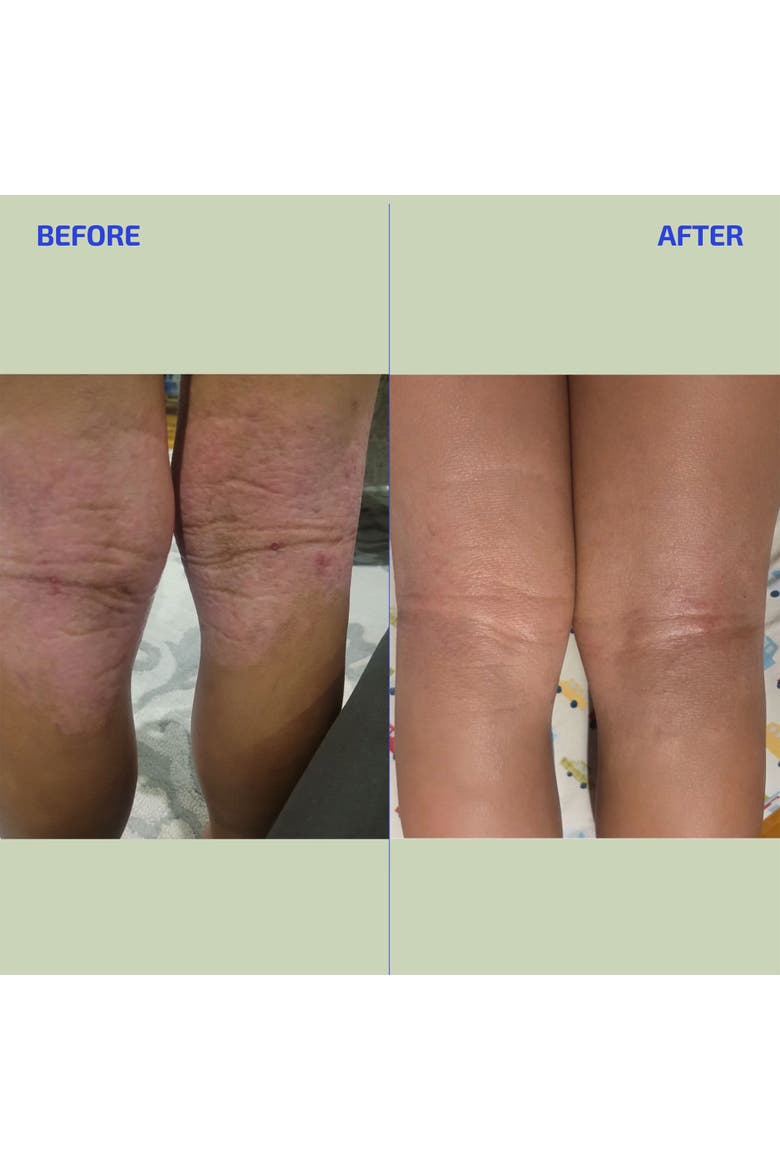 BIA Eczema Relief Lotion, Alternate, color, Tan
